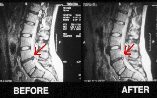 before_after.jpg